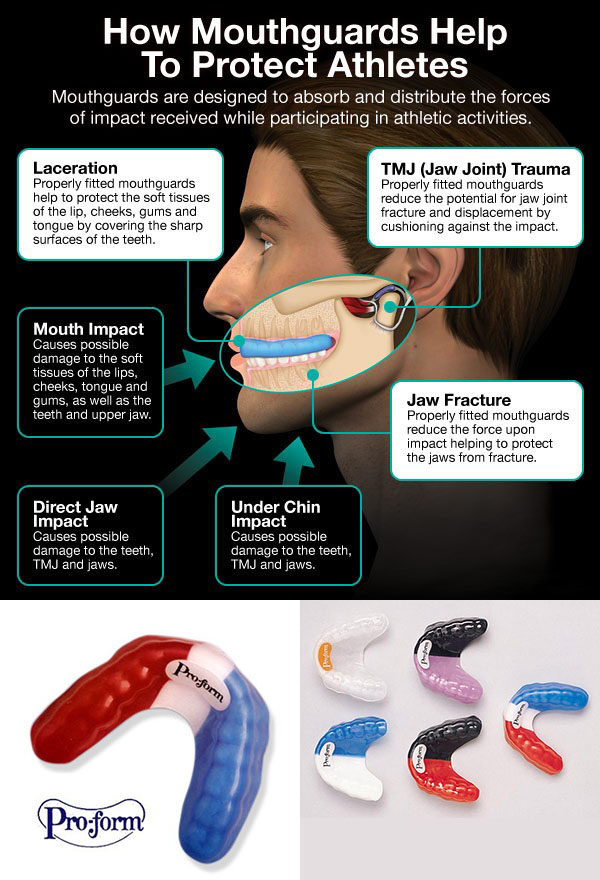 Dentist Bellville  Sports Mouthguards